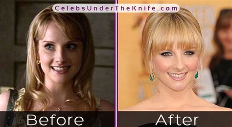 melissa rauch nide|Melissa Rauch Breast Implants and Reductions